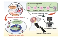 A novel marsupial robotic system for cross-scale targeted drug delivery in glioma treatment