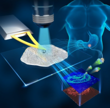 Shenyang Institute of Automation proposes fluorescence-mechanical co-labelling system to assist gastric cancer invasiveness research